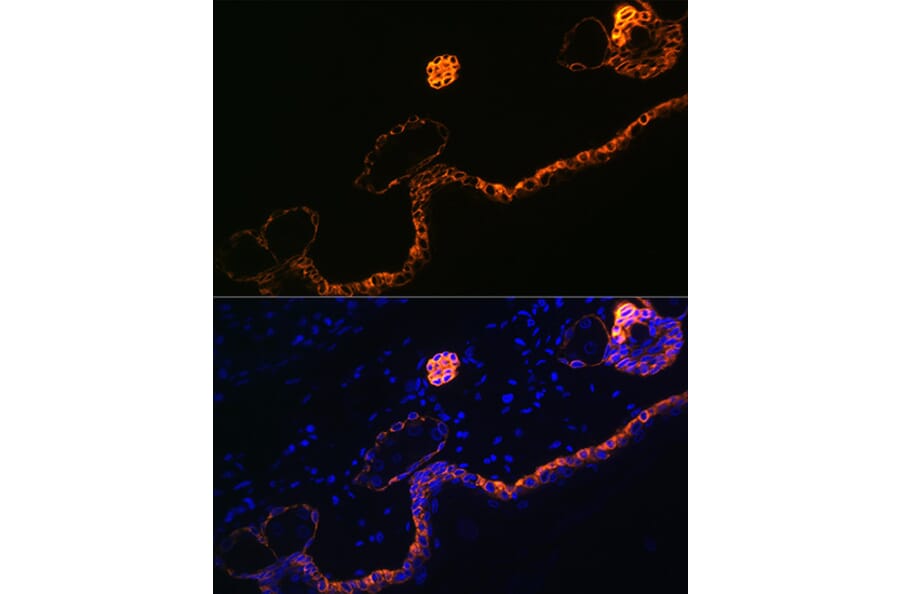 Immunofluorescence - Anti-Cytokeratin 5 Antibody [ARC0585] (A80808) - Antibodies.com