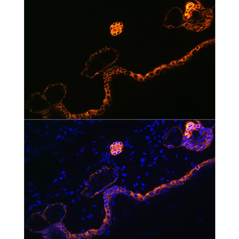 Immunofluorescence - Anti-Cytokeratin 5 Antibody [ARC0585] (A80808) - Antibodies.com
