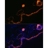 Immunofluorescence - Anti-Cytokeratin 5 Antibody [ARC0585] (A80808) - Antibodies.com