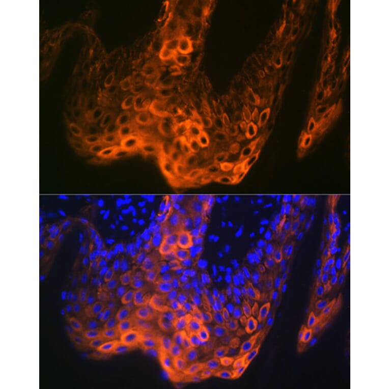 Immunofluorescence - Anti-Cytokeratin 5 Antibody [ARC0585] (A80808) - Antibodies.com