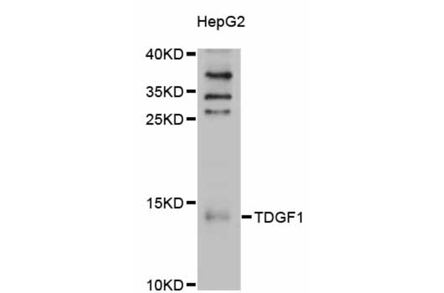 Western Blot - Anti-TDGF1 Antibody (A11415) - Antibodies.com