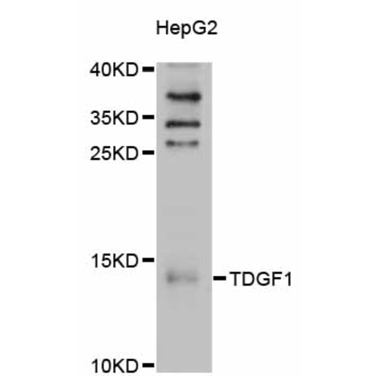 Western Blot - Anti-TDGF1 Antibody (A11415) - Antibodies.com