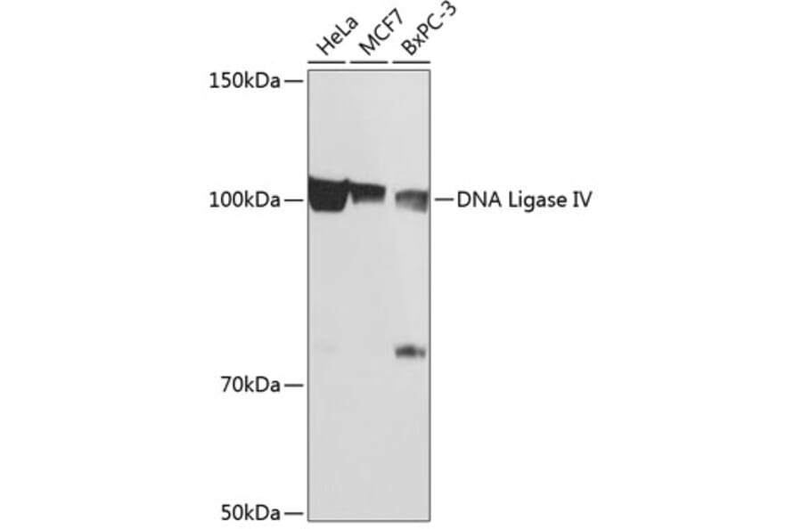 Western Blot - Anti-DNA Ligase IV/LIG4 Antibody (A80811) - Antibodies.com