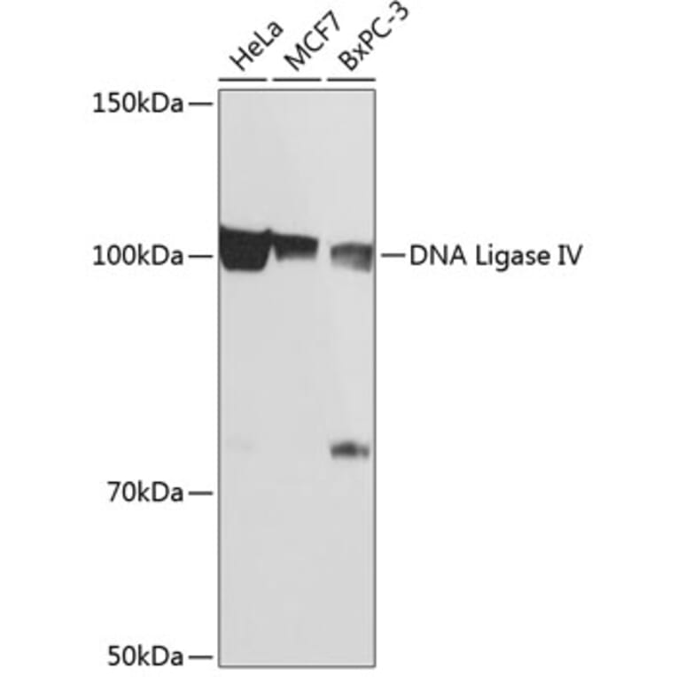 Western Blot - Anti-DNA Ligase IV/LIG4 Antibody (A80811) - Antibodies.com