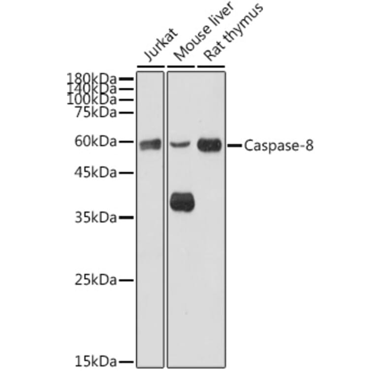 Western Blot - Anti-Caspase-8 Antibody (A80812) - Antibodies.com