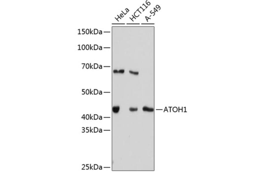 Western Blot - Anti-MATH1/HATH1 Antibody [ARC0609] (A80815) - Antibodies.com