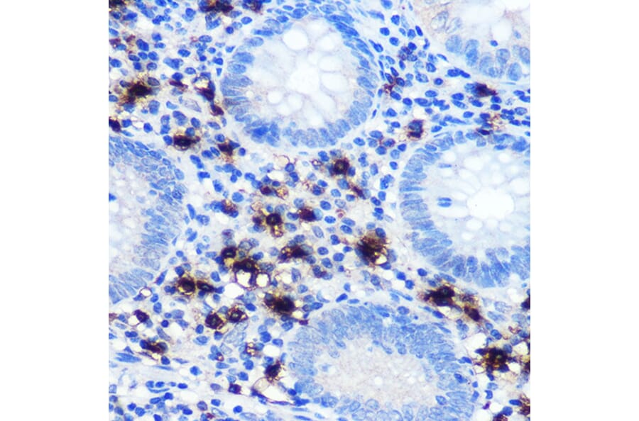 IHC - Anti-Mast Cell Chymase Antibody [ARC0614] (A80816)