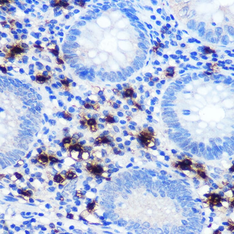 Immunohistochemistry - Anti-Mast Cell Chymase Antibody [ARC0614] (A80816) - Antibodies.com