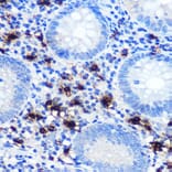 Immunohistochemistry - Anti-Mast Cell Chymase Antibody [ARC0614] (A80816) - Antibodies.com
