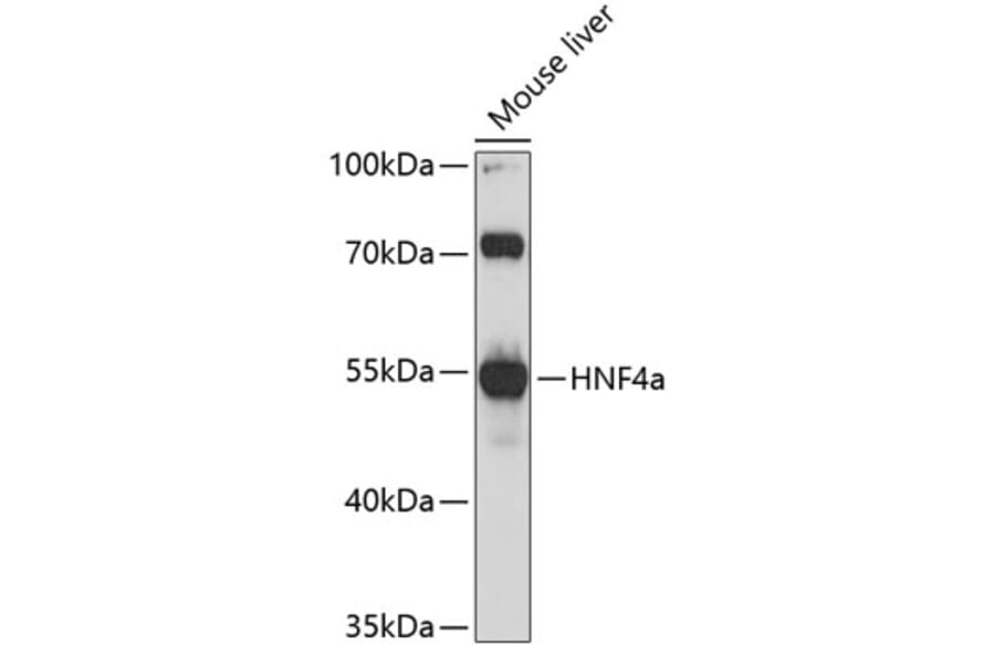 Western Blot - Anti-HNF-4-alpha Antibody (A80819) - Antibodies.com
