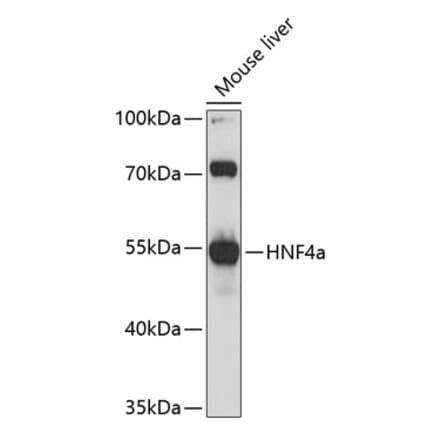 Western Blot - Anti-HNF-4-alpha Antibody (A80819) - Antibodies.com