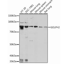 Western Blot - Anti-GOLPH2 Antibody [ARC0697] (A80822) - Antibodies.com