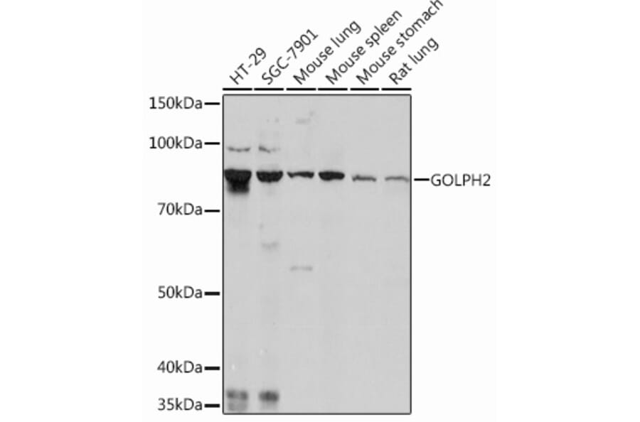 Western Blot - Anti-GOLPH2 Antibody [ARC0697] (A80822) - Antibodies.com