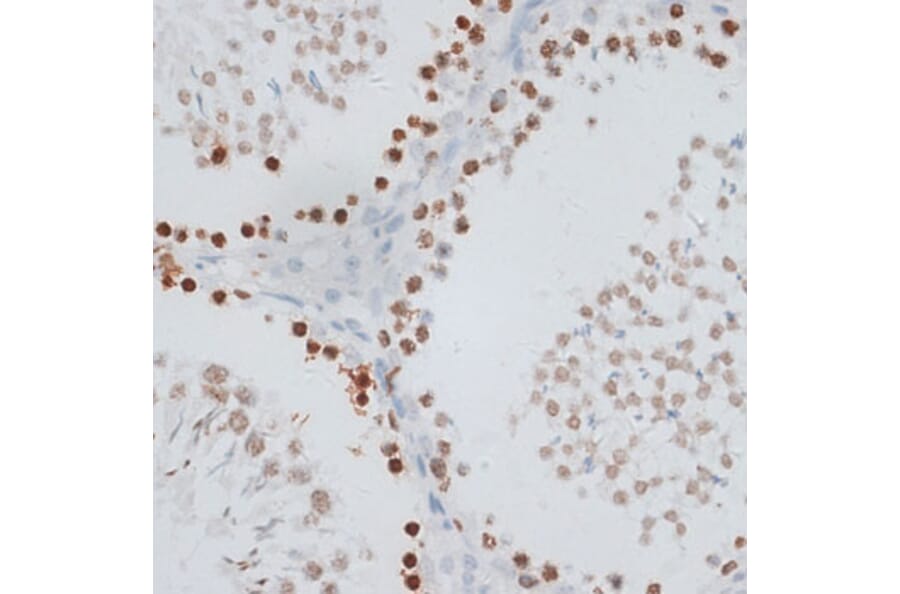 Immunohistochemistry - Anti-Histone H2AX Antibody (A11540) - Antibodies.com