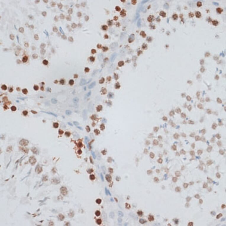 Immunohistochemistry - Anti-Histone H2AX Antibody (A11540) - Antibodies.com
