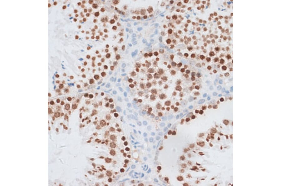 Immunohistochemistry - Anti-Histone H2AX Antibody (A11540) - Antibodies.com