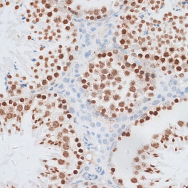 Immunohistochemistry - Anti-Histone H2AX Antibody (A11540) - Antibodies.com