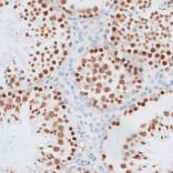 Immunohistochemistry - Anti-Histone H2AX Antibody (A11540) - Antibodies.com