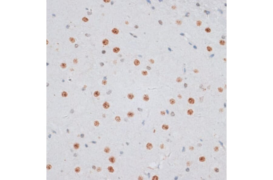 Immunohistochemistry - Anti-Histone H2AX Antibody (A11540) - Antibodies.com