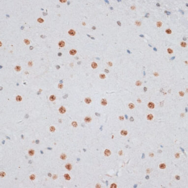 Immunohistochemistry - Anti-Histone H2AX Antibody (A11540) - Antibodies.com