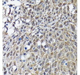 Immunohistochemistry - Anti-BRCA1 Antibody (A80824) - Antibodies.com