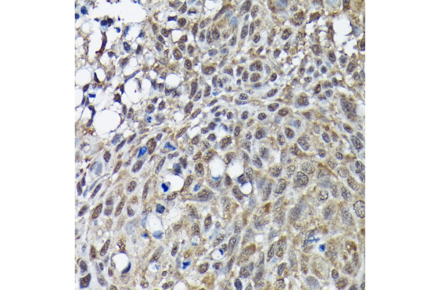 Immunohistochemistry - Anti-BRCA1 Antibody (A80824) - Antibodies.com