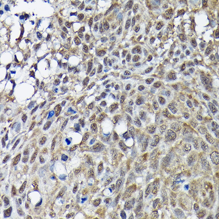 Immunohistochemistry - Anti-BRCA1 Antibody (A80824) - Antibodies.com