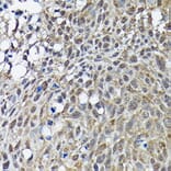 Immunohistochemistry - Anti-BRCA1 Antibody (A80824) - Antibodies.com