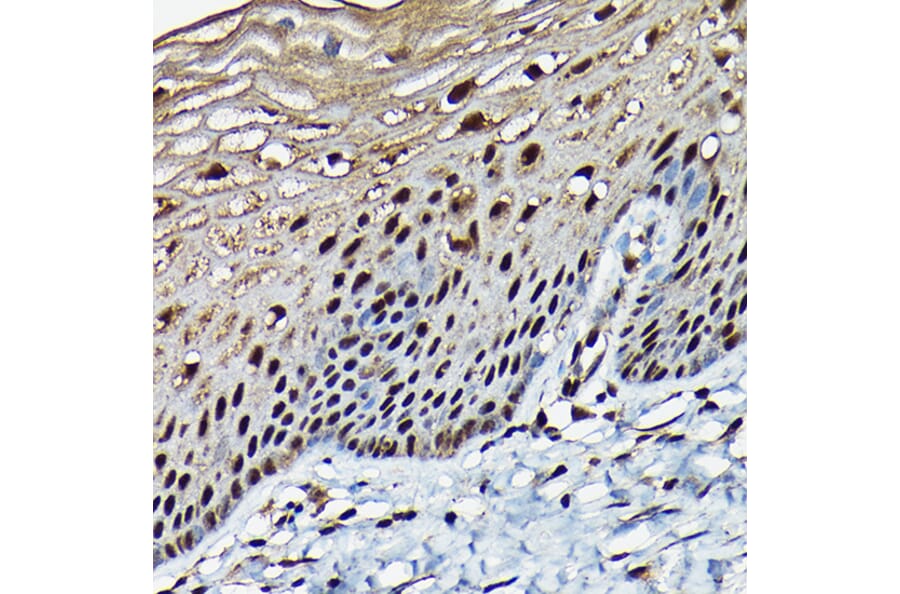 Immunohistochemistry - Anti-BRCA1 Antibody (A80824) - Antibodies.com