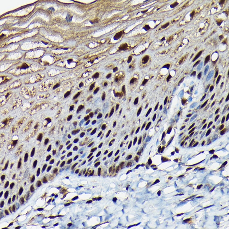 Immunohistochemistry - Anti-BRCA1 Antibody (A80824) - Antibodies.com