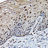 Immunohistochemistry - Anti-BRCA1 Antibody (A80824) - Antibodies.com