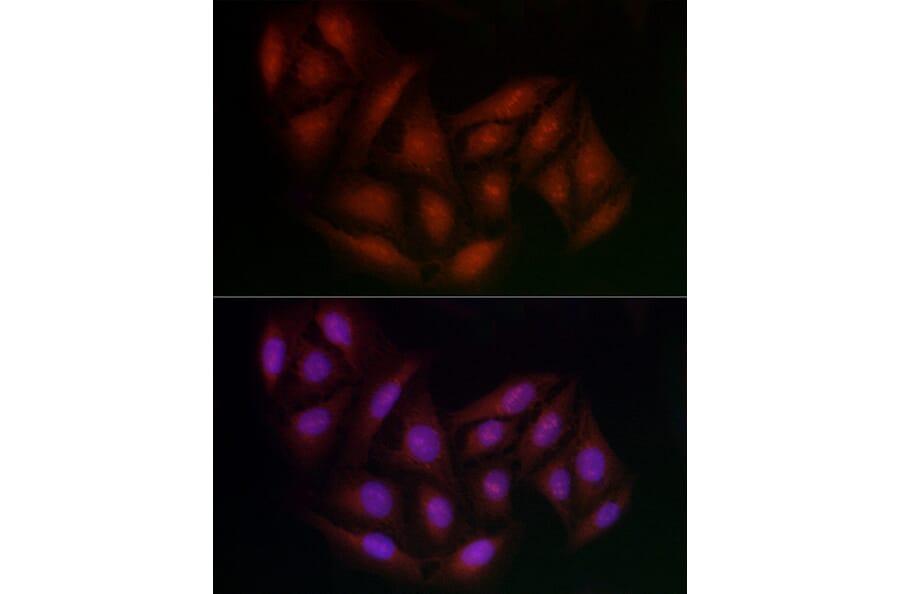 Immunofluorescence - Anti-BRCA1 Antibody (A80824) - Antibodies.com