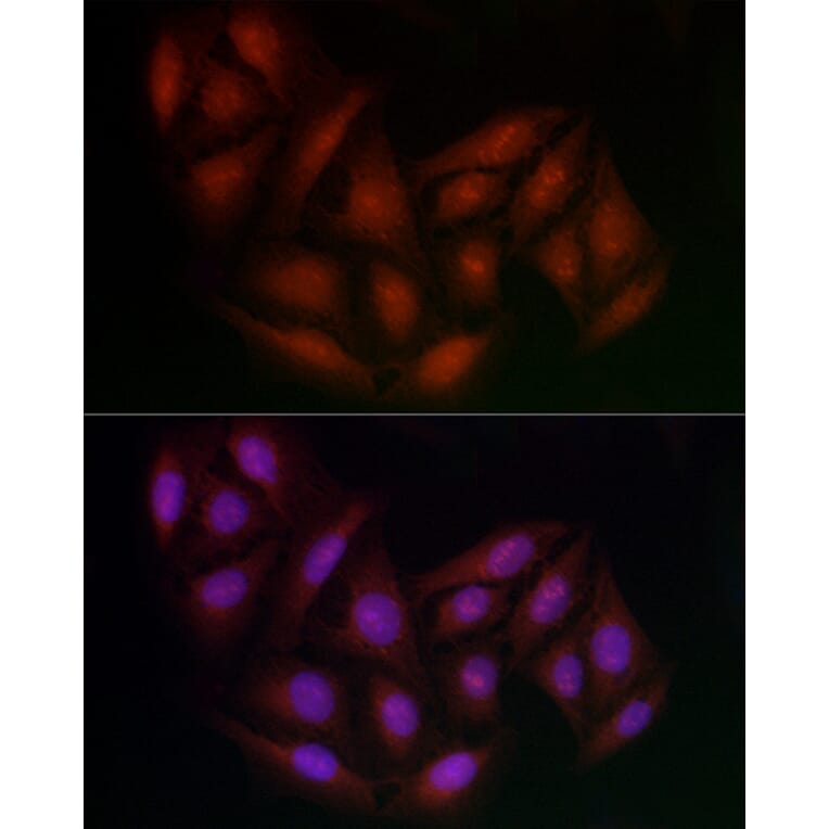 Immunofluorescence - Anti-BRCA1 Antibody (A80824) - Antibodies.com