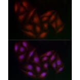 Immunofluorescence - Anti-BRCA1 Antibody (A80824) - Antibodies.com