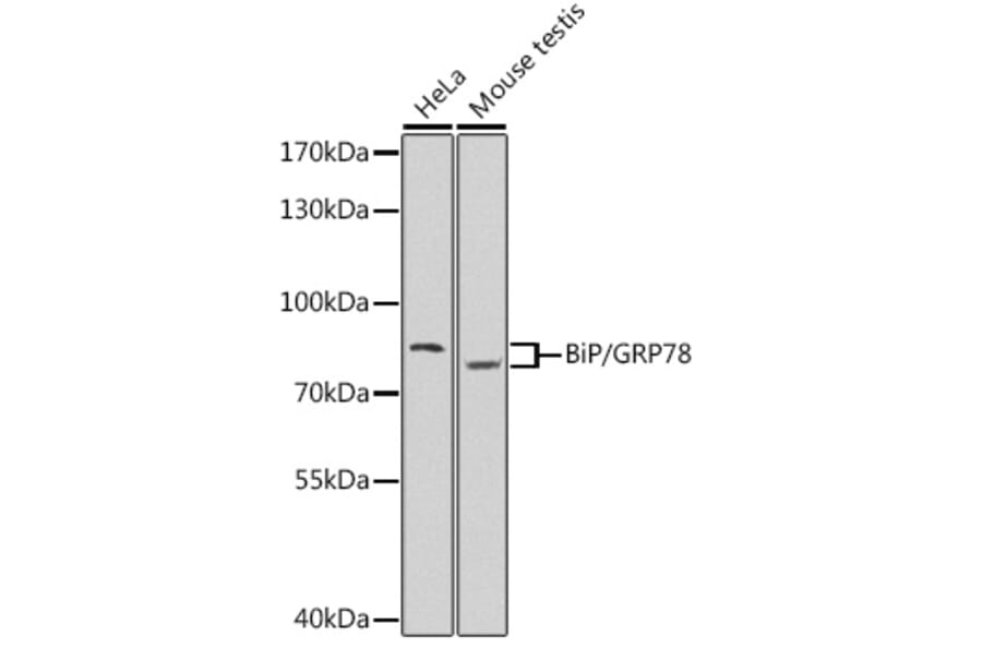 Western Blot - Anti-GRP78 BiP Antibody (A80827) - Antibodies.com