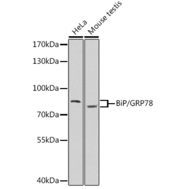 Western Blot - Anti-GRP78 BiP Antibody (A80827) - Antibodies.com