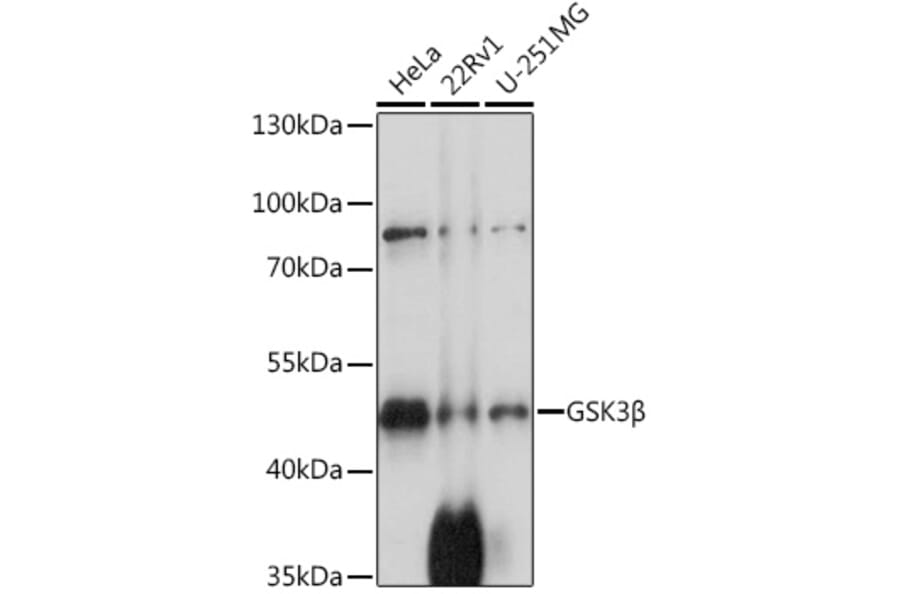 Western Blot - Anti-GSK3 beta Antibody (A80829) - Antibodies.com