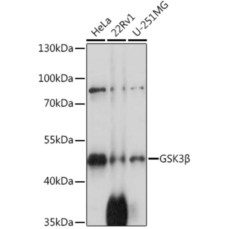 Western Blot - Anti-GSK3 beta Antibody (A80829) - Antibodies.com