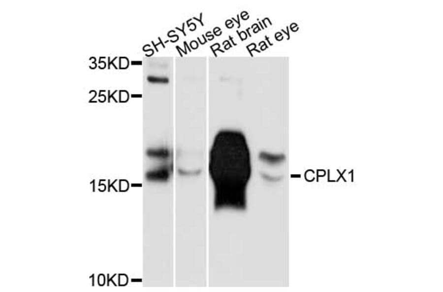 Western Blot - Anti-CPLX1 Antibody (A11588) - Antibodies.com