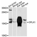 Western Blot - Anti-CPLX1 Antibody (A11588) - Antibodies.com