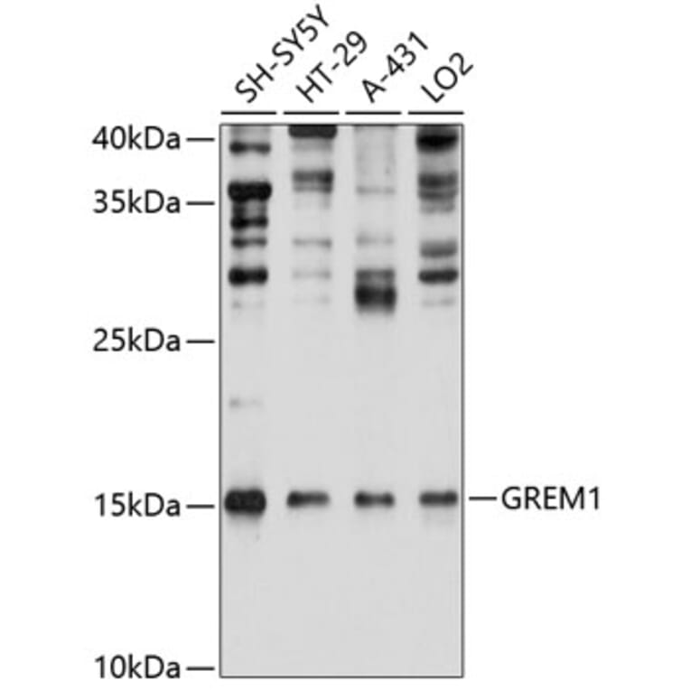 Western Blot - Anti-Gremlin 1 Antibody (A80831) - Antibodies.com