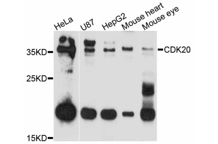 Western Blot - Anti-CDK20 Antibody (A11599) - Antibodies.com