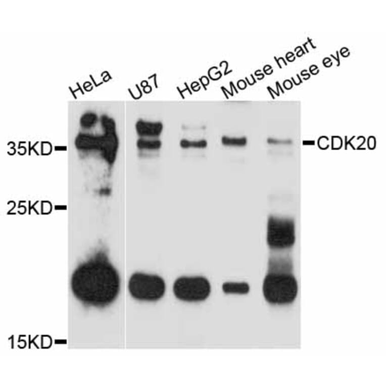 Western Blot - Anti-CDK20 Antibody (A11599) - Antibodies.com