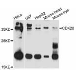 Western Blot - Anti-CDK20 Antibody (A11599) - Antibodies.com