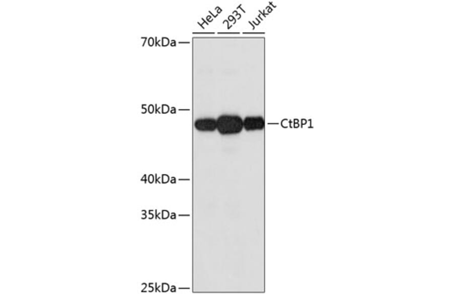Western Blot - Anti-CtBP1 Antibody [ARC0642] (A80833) - Antibodies.com