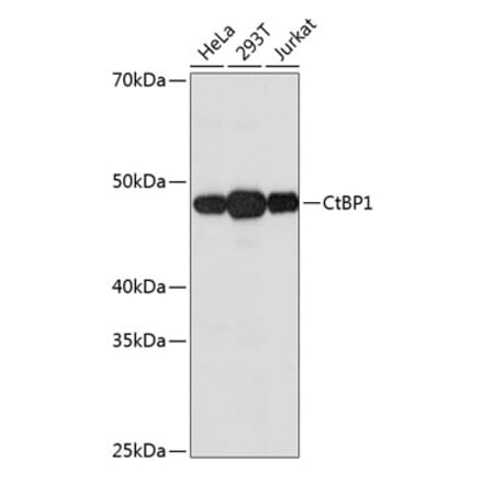 Western Blot - Anti-CtBP1 Antibody [ARC0642] (A80833) - Antibodies.com