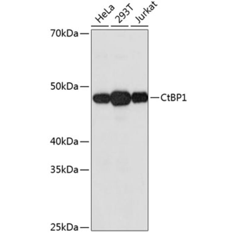 Western Blot - Anti-CtBP1 Antibody [ARC0642] (A80833) - Antibodies.com