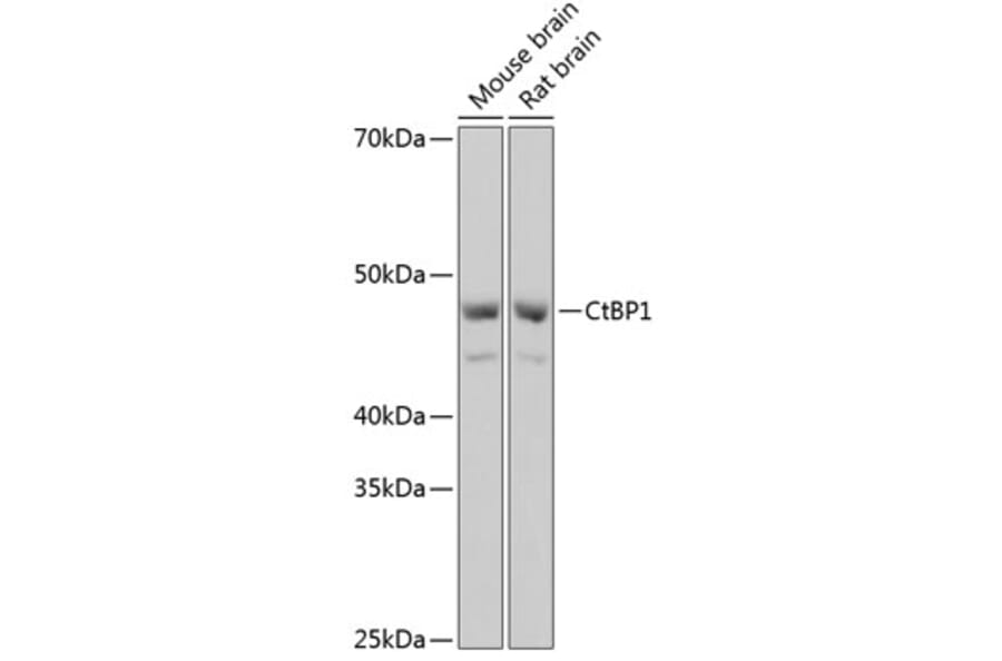 Western Blot - Anti-CtBP1 Antibody [ARC0642] (A80833) - Antibodies.com