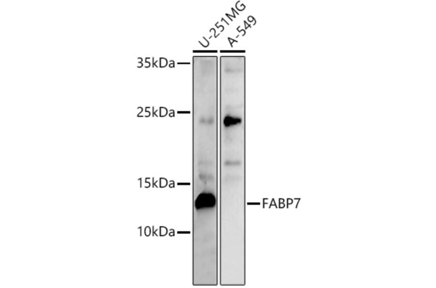 Western Blot - Anti-BLBP Antibody (A80835) - Antibodies.com