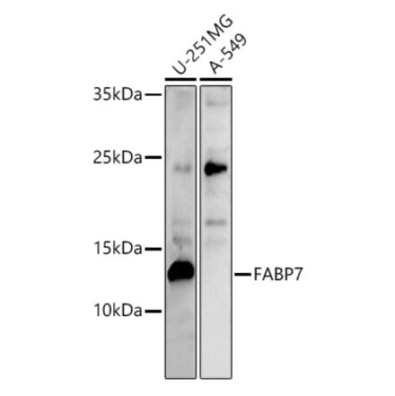 Western Blot - Anti-BLBP Antibody (A80835) - Antibodies.com